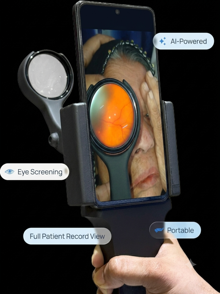 Lunera Fundus Cam